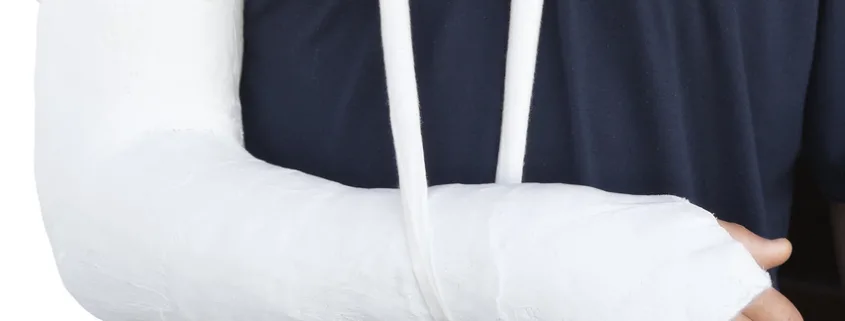 Bras dans le plâtre, soutenu par une écharpe blanche, pour les risques du métier