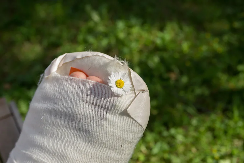 Gipsfuß Pied plâtré dans un bandage, orteils sortant, marguerite posée dessus, sur fond d'herbe